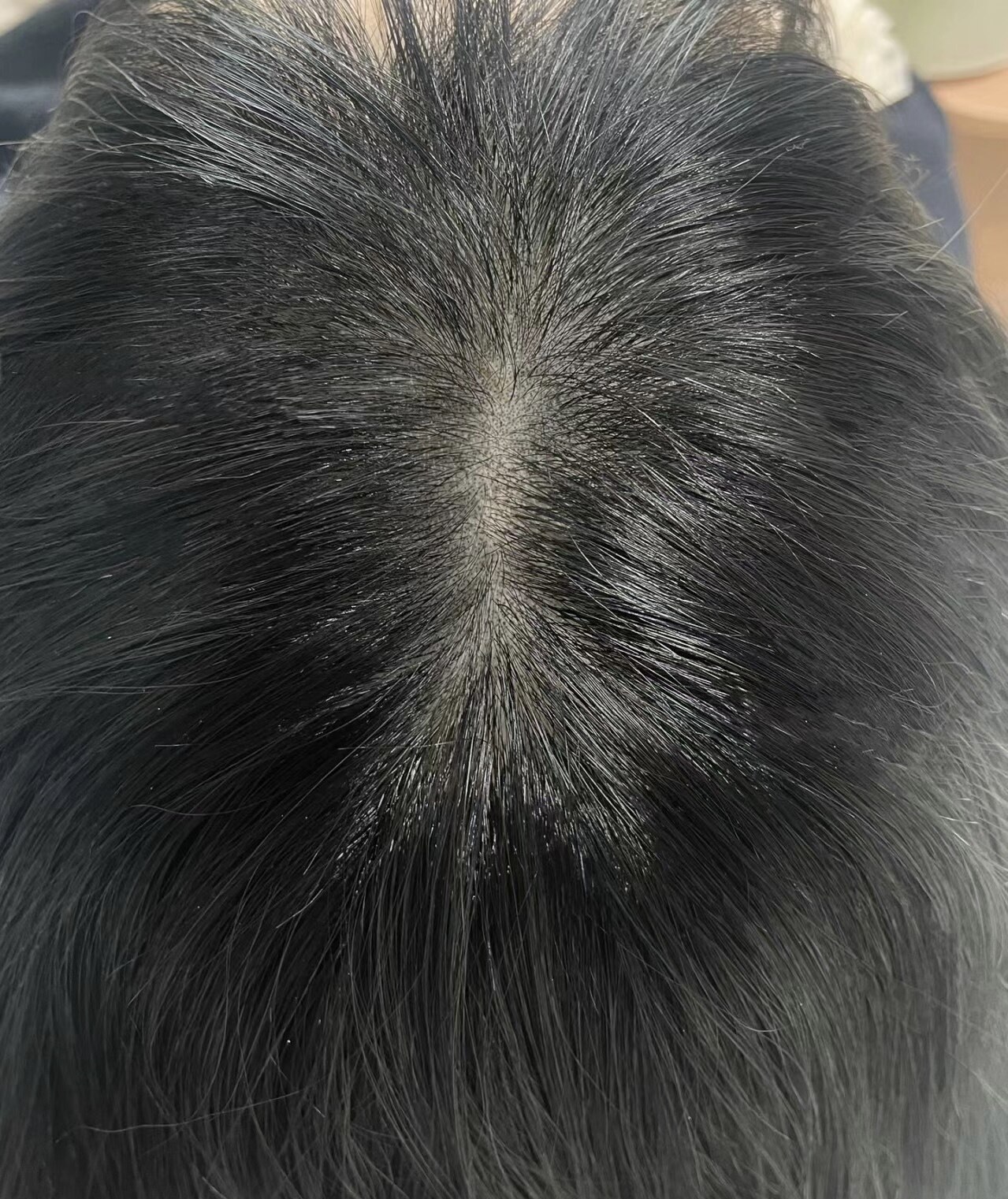 After
