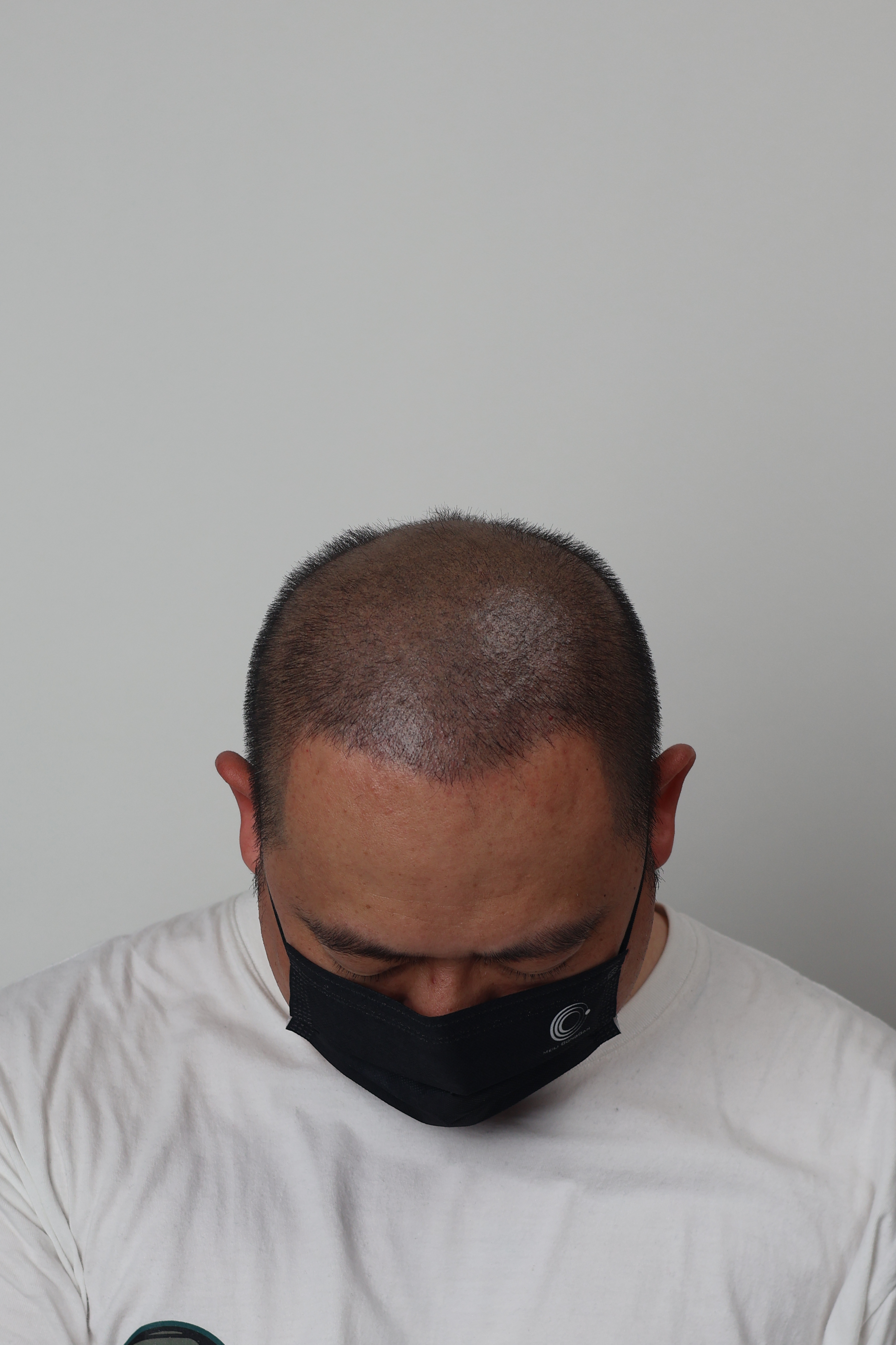 After