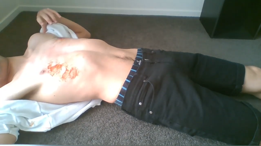 cpr