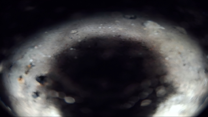 Case 4 Image 3