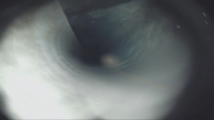Case 2 Image 2