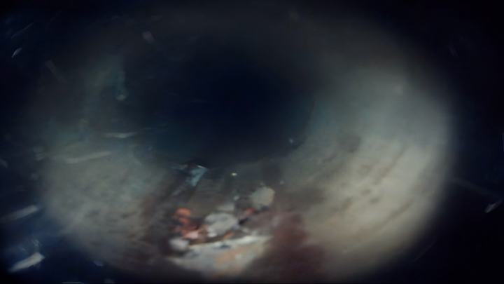 Case 3 Image 2