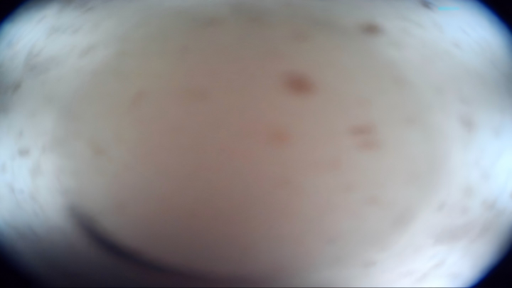 Case 5 Image 3