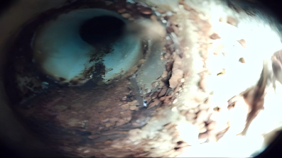 Case 2 Image 3
