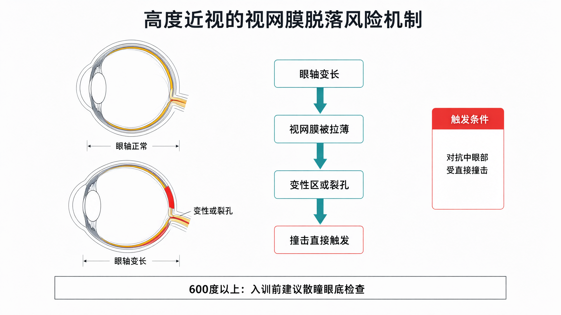 近视眼/高度近视能练MMA吗？