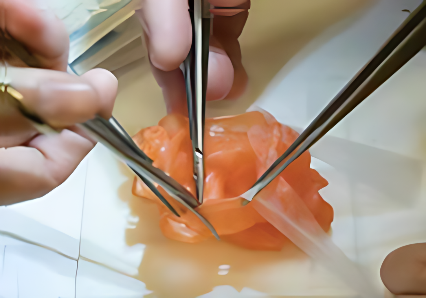 医学与生物3D打印