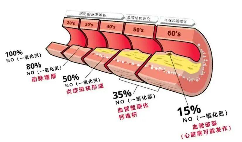 血管健康“预警信号”:一氧化氮(NO)检测的临床价值与应用
