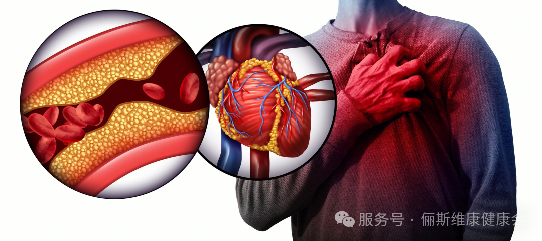为什么天一冷,心梗脑梗就犯了