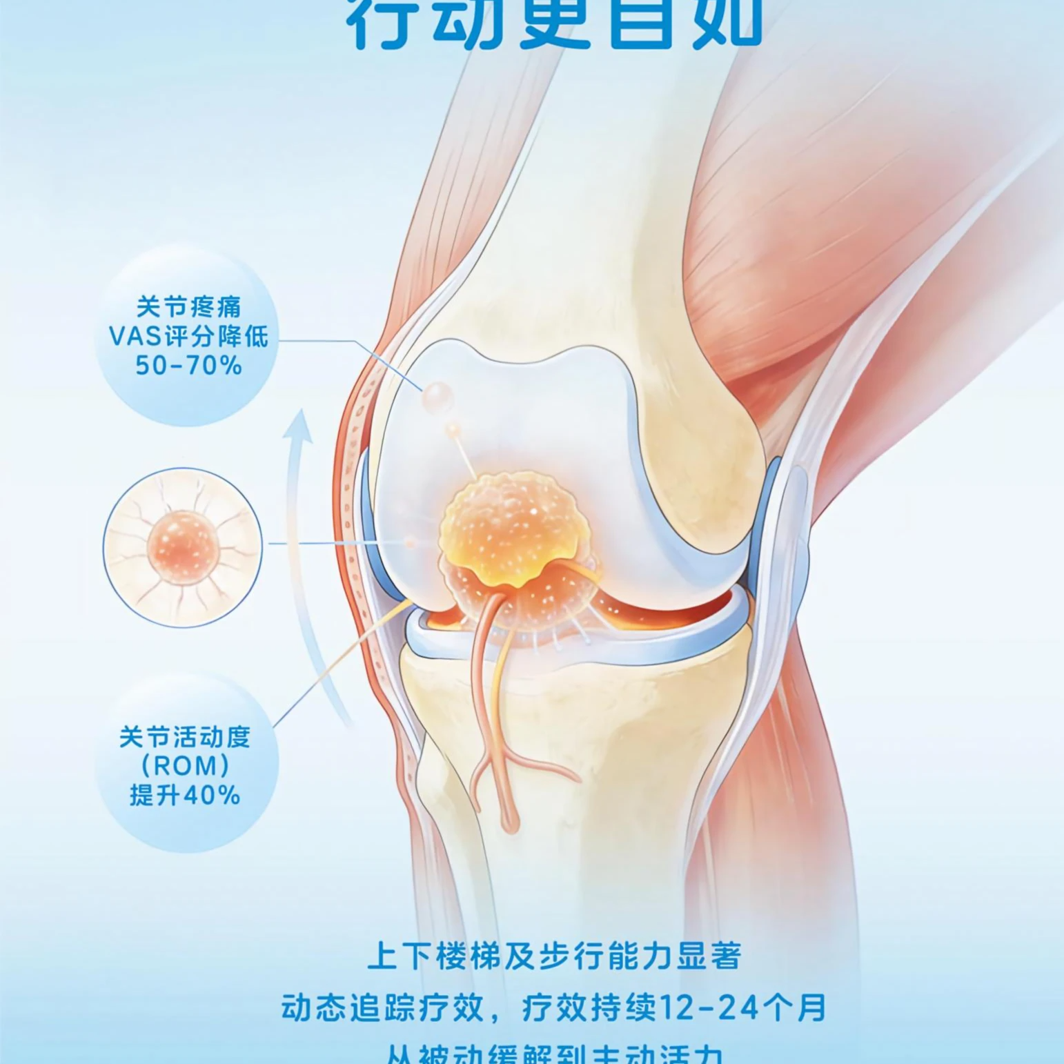 骨关节炎