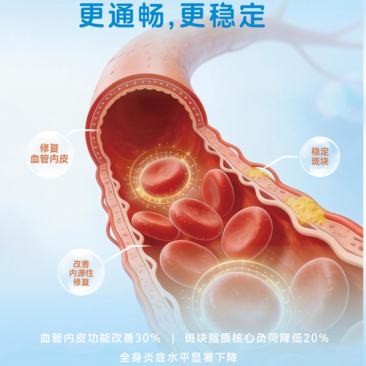 动脉粥样硬化
