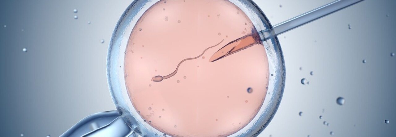 IVF 实验室程序
