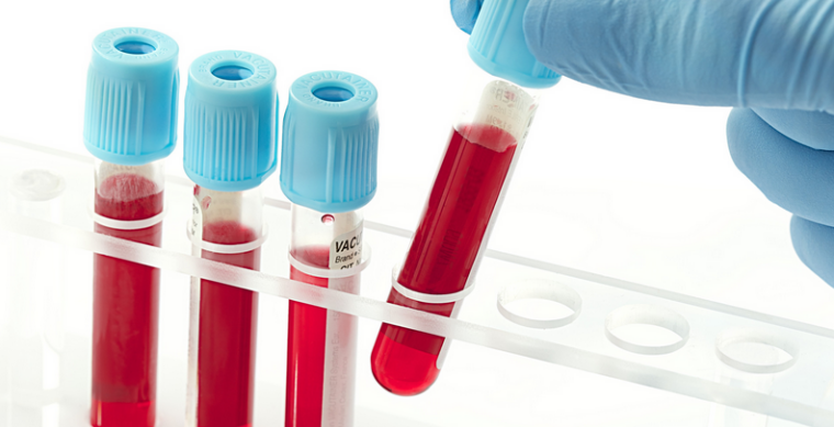 Method for Determination of Lipid-Soluble Vitamins in Human Serum Using Anyeep TQ9100