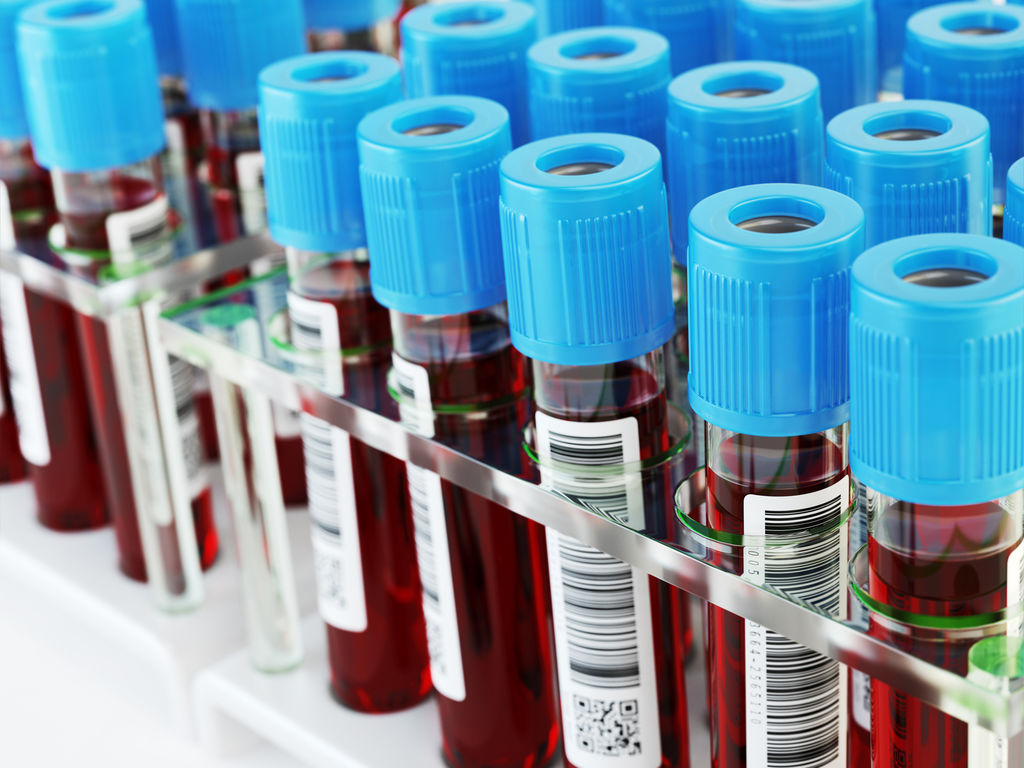 Quantify 15 bile acids in human plasma using Anyeep TQ9100