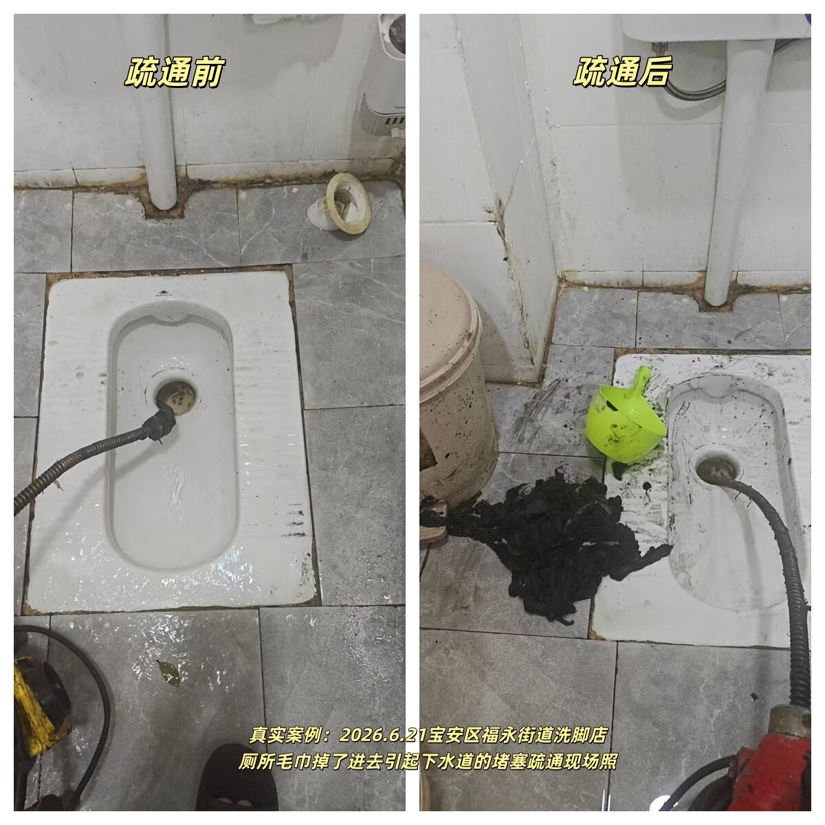 深圳市宝安区西乡街道宋师傅诚信下水道疏通店福永洗脚店厕所毛巾堵塞疏通案例
