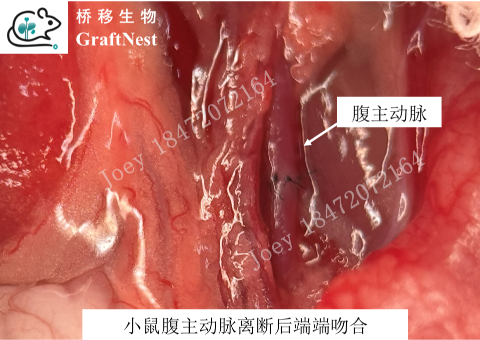 小鼠腹主动脉端端吻合