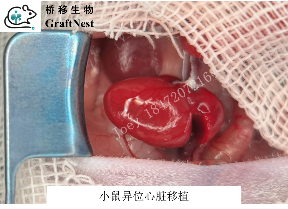 恢复血供与关腹