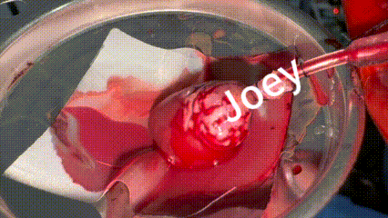 Vascular Anastomosis