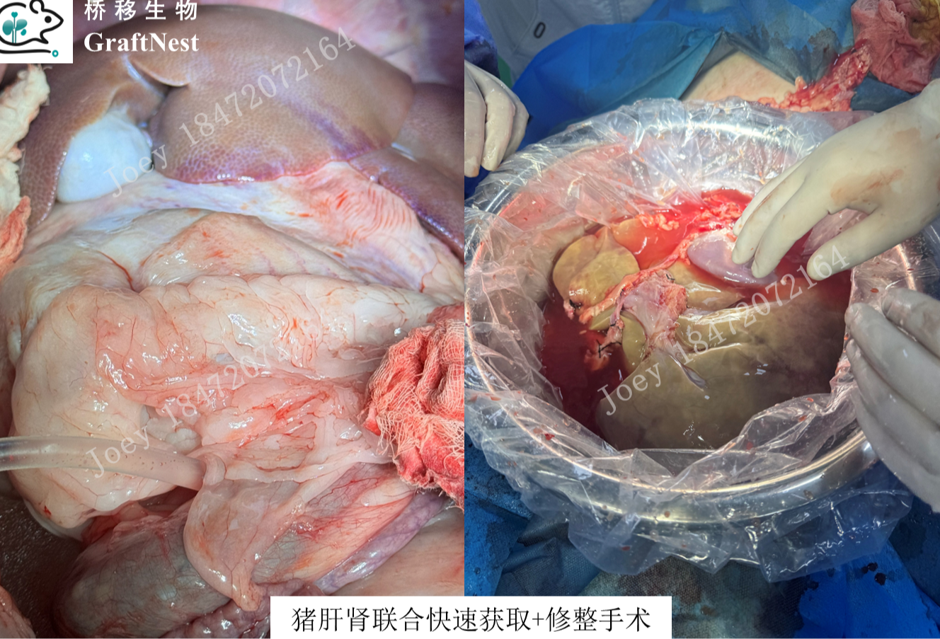 猪肾获取手术实拍