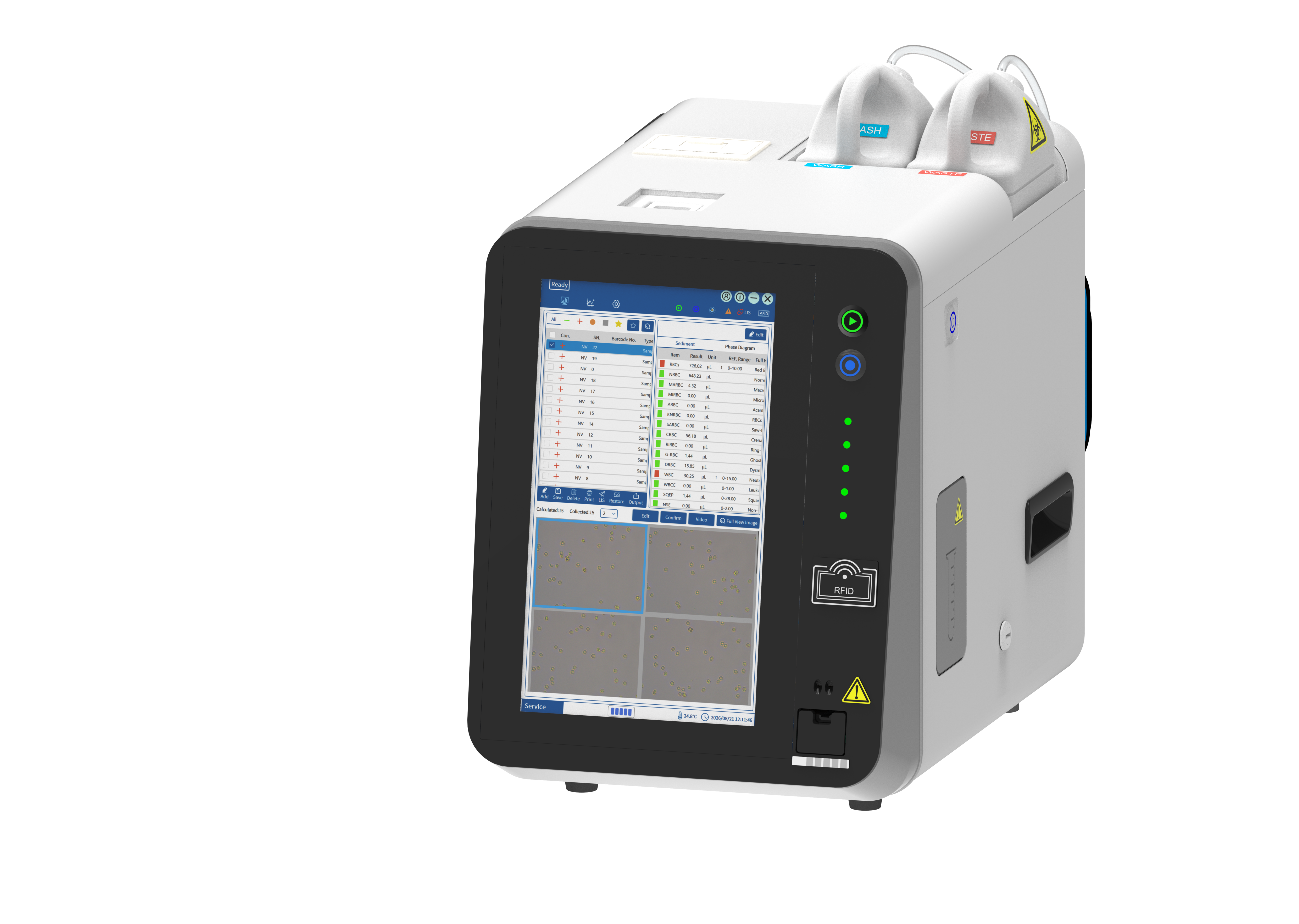 Urine analyzer device in a modern medical laboratory