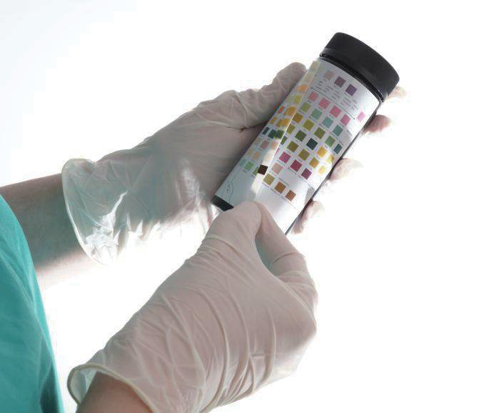 URS Visual Test Strips