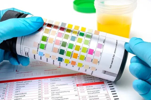 Urine Test Strips