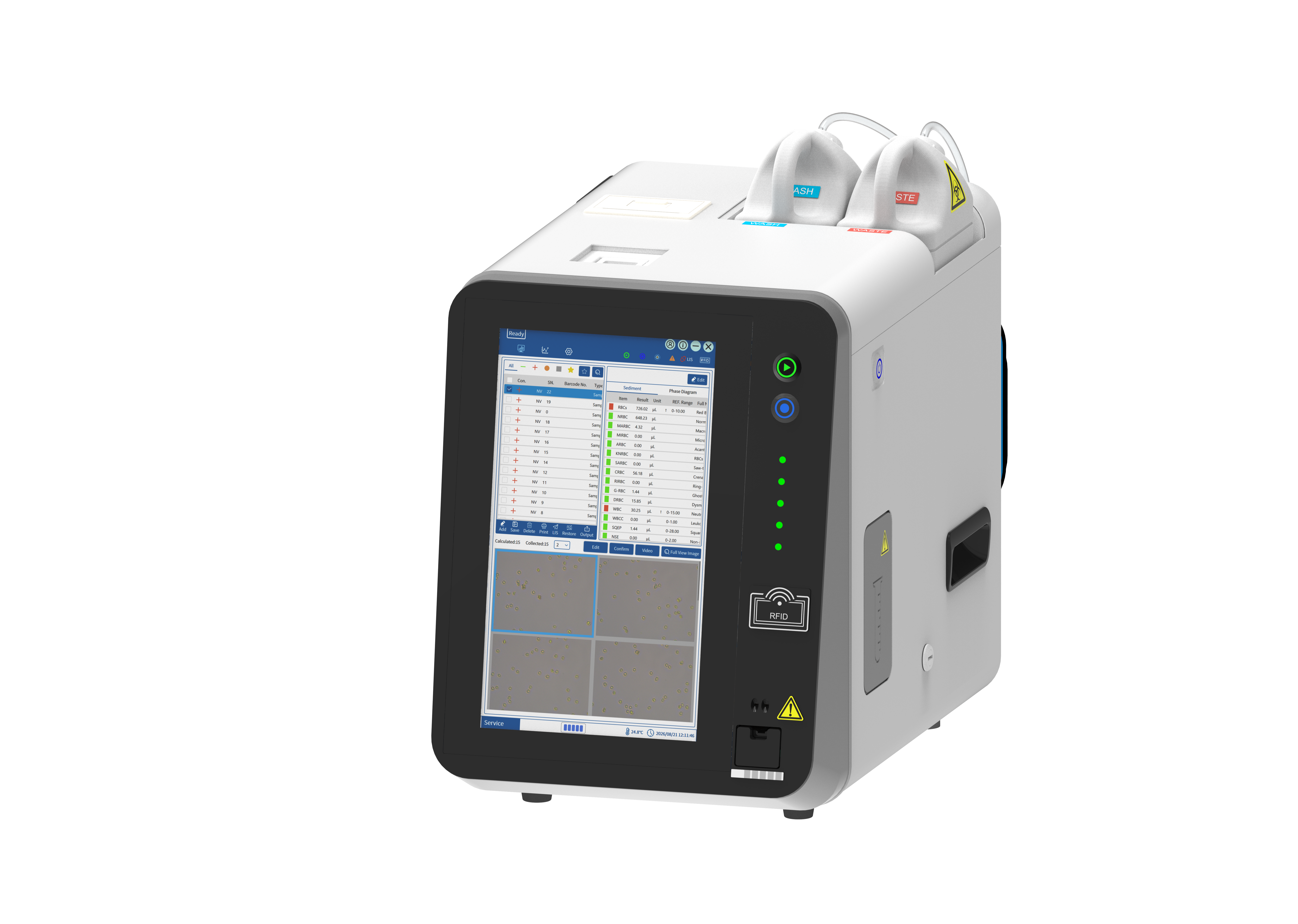 Urinalysis Hybrid System