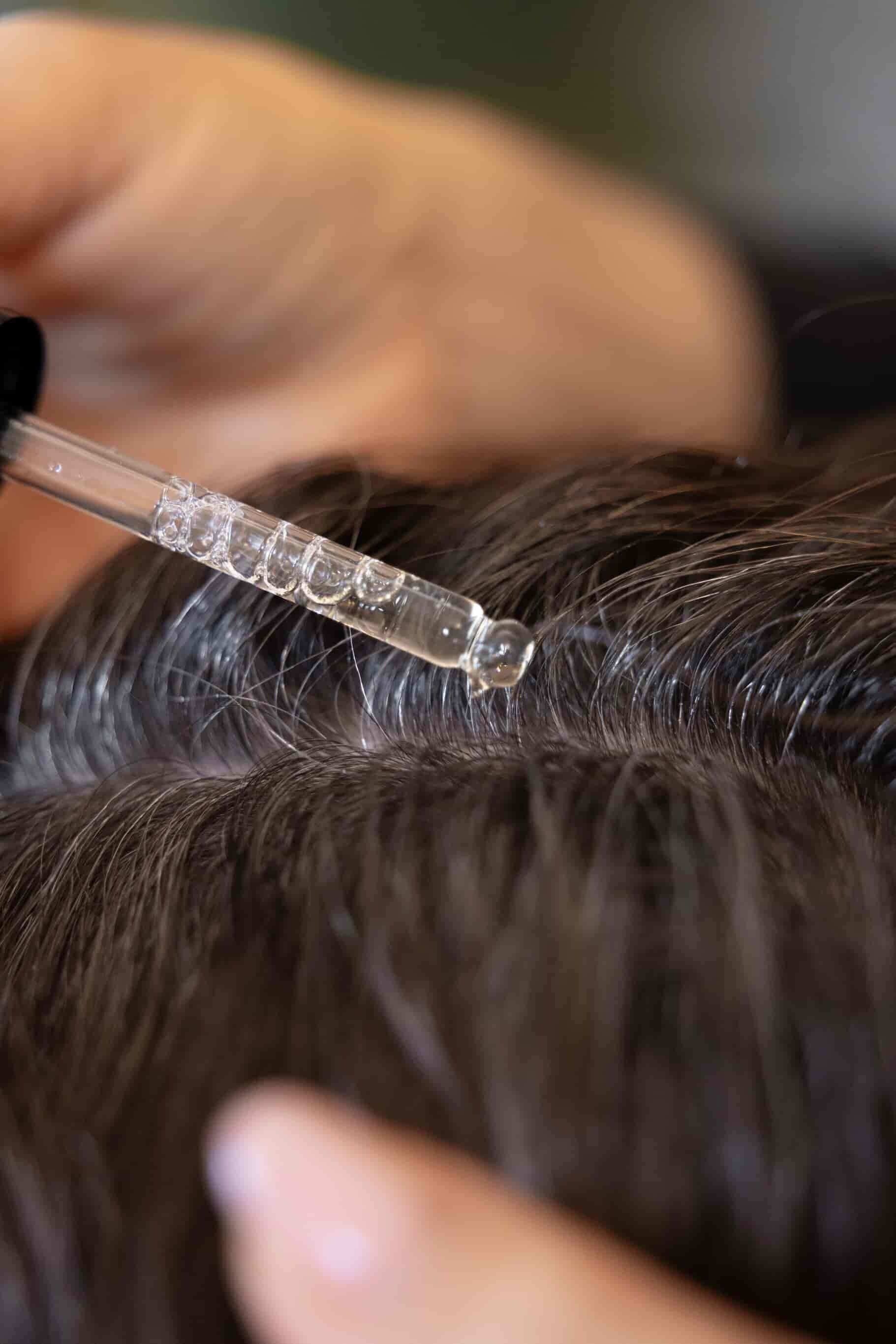 Intensive scalp serum hair spa treatment at Deluxe Spa & Beauty Yagoona clinic