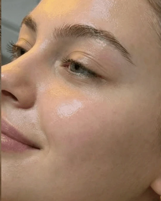 After oxygen glass skin facial treatment at Three Sisters Beauty Burwood, showing hydrated glowing skin