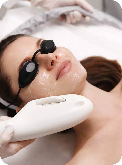DPL photon skin rejuvenation treatment at Three Sisters Beauty Burwood Sydney