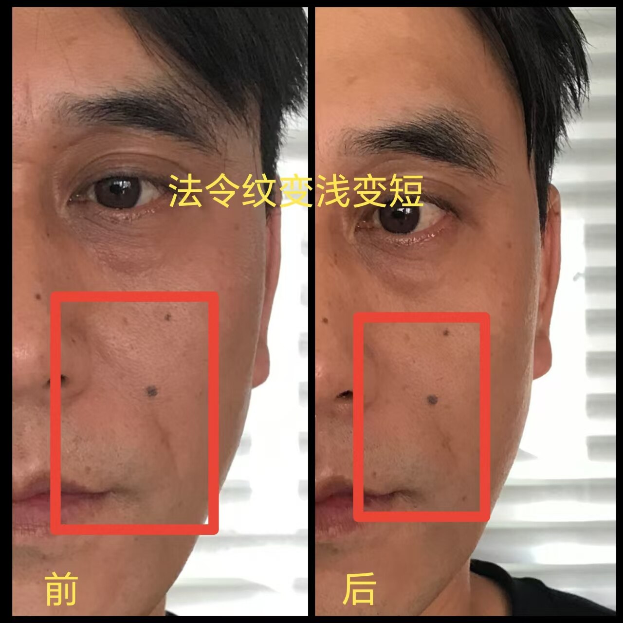 使用后