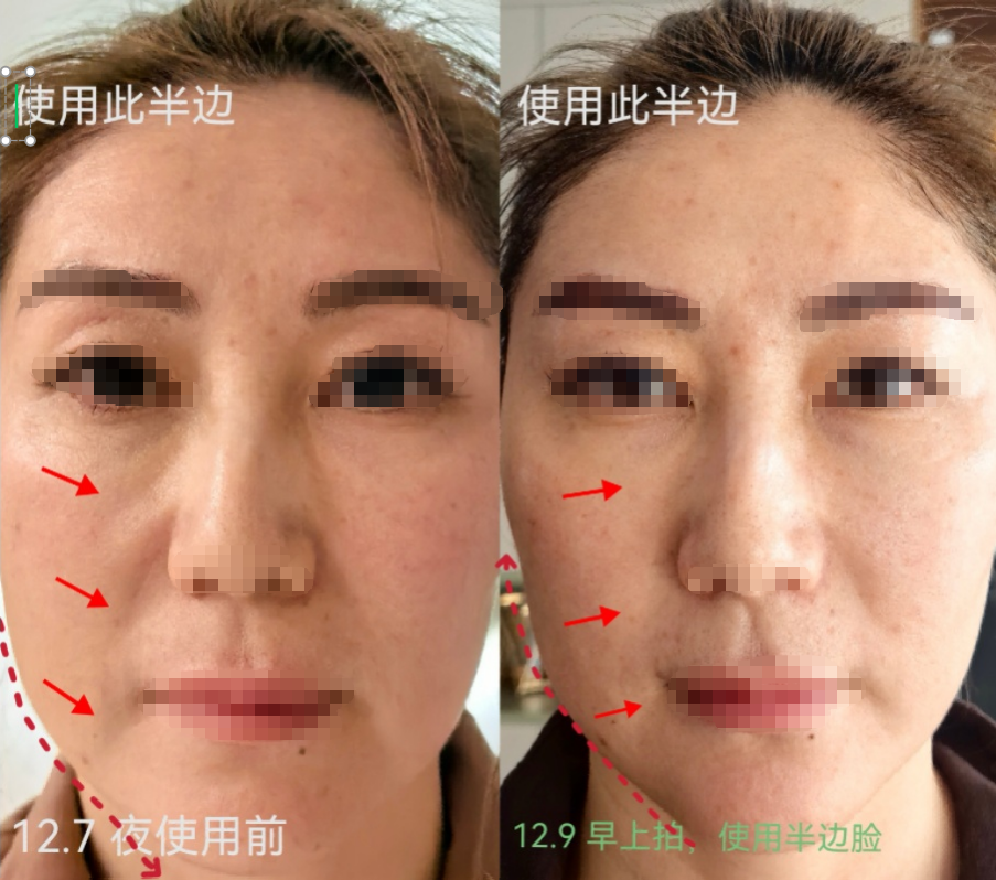 使用前
