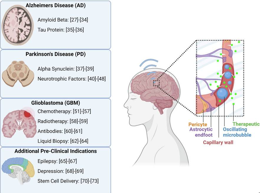 Application Scenarios for Blood-Brain Barrier Opening Technology