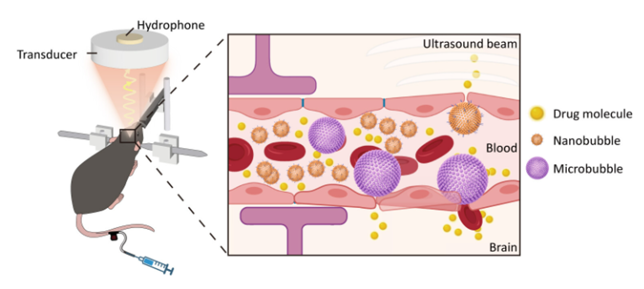 Principles of Blood-Brain Barrier Opening Technology