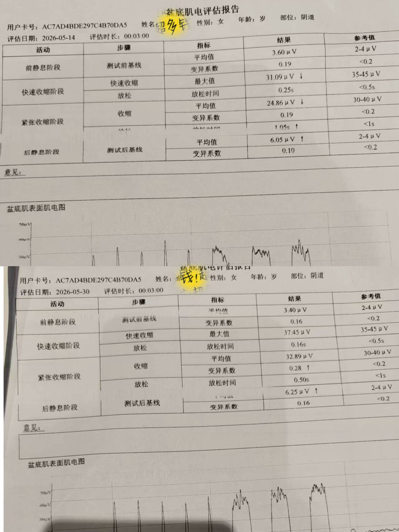 成都产后修复_应激体质盆底肌养护_盆底肌检测报告前后对比