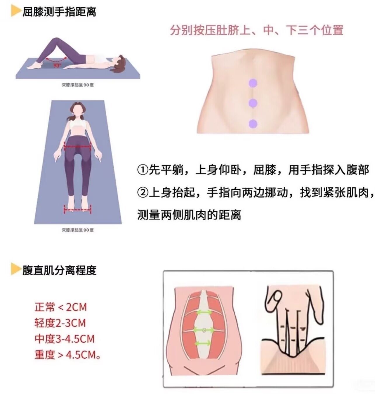 成都产后修复_腹直肌分离症状与正常对比示意图