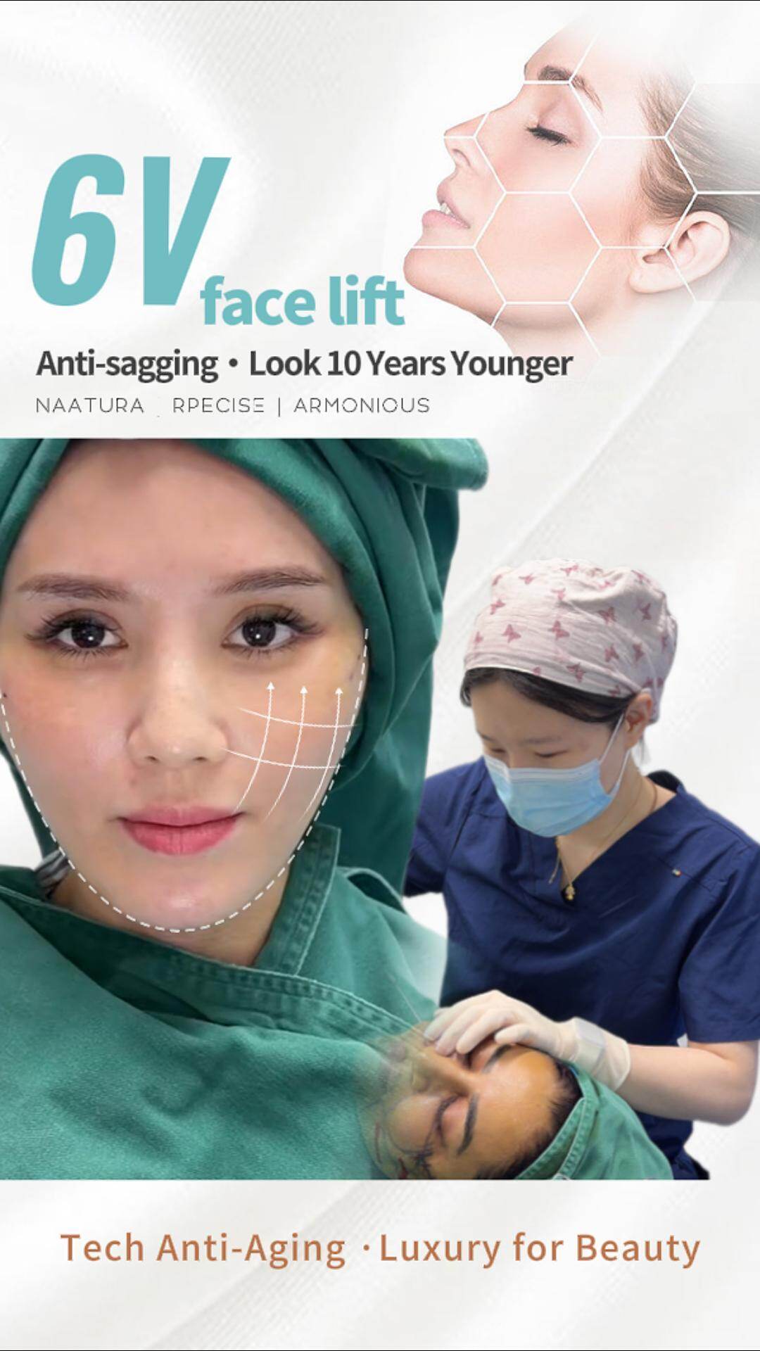 Facelift Case Studies