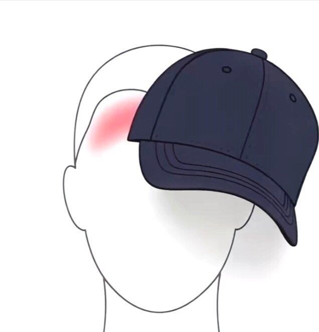 Pain points of traditional hats